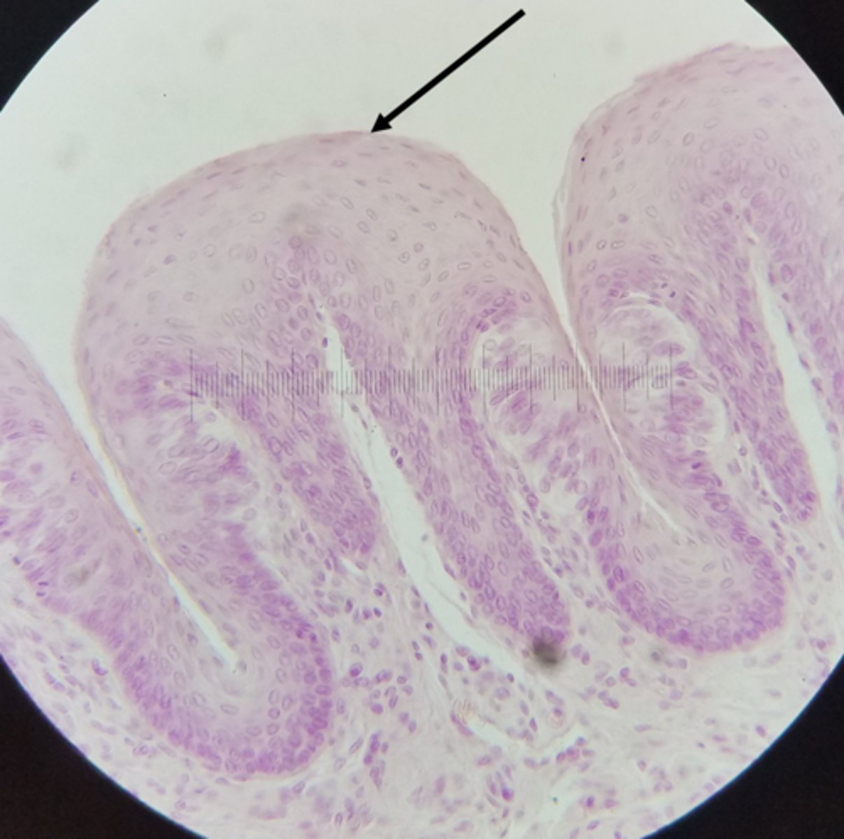 <p>an upper free surface exposed to the body exterior or the cavity of an internal organ</p>