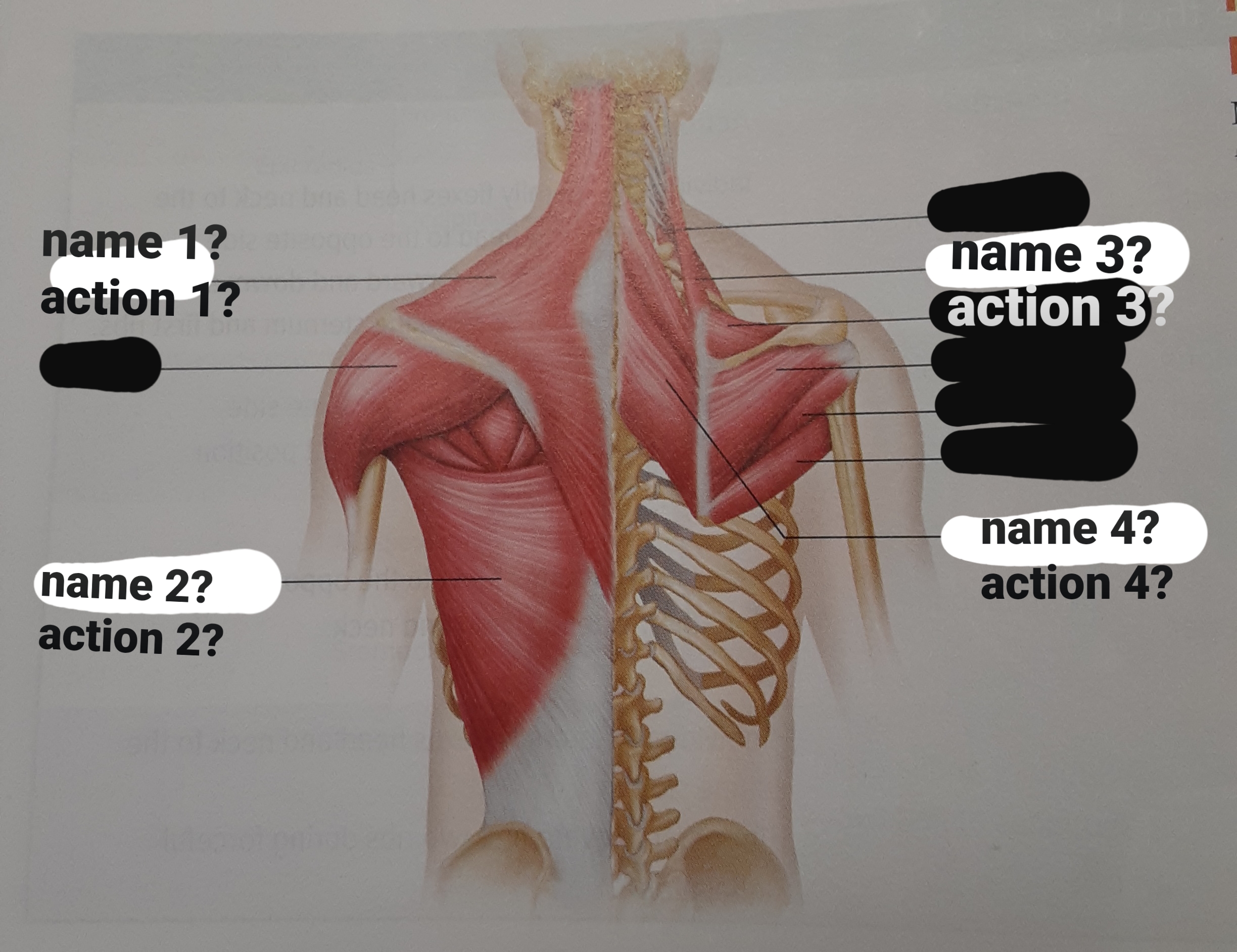 <p>trapezius</p>