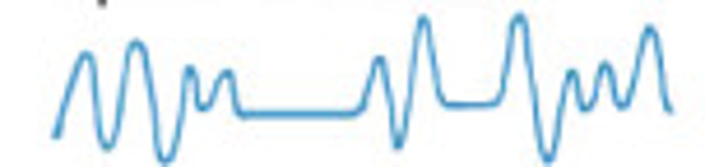 <p>a dangerous, highly irregular breathing pattern characterized by groups of rapid, shallow breaths followed by irregular periods of apnea (pauses)</p>