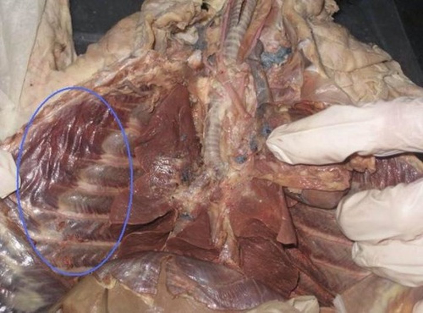 <p>lines the thoracic cavity</p>