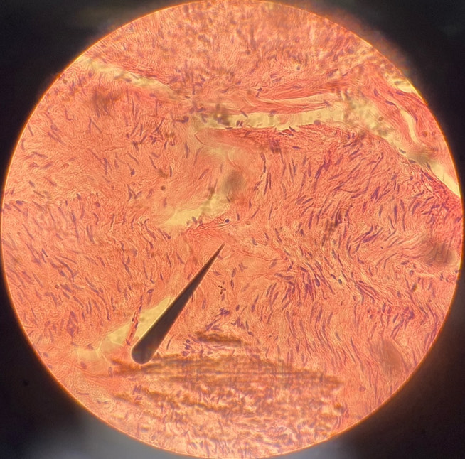 <p>example: hollow organs (uterus, stomach)<br>function: involuntary movement of substances</p>