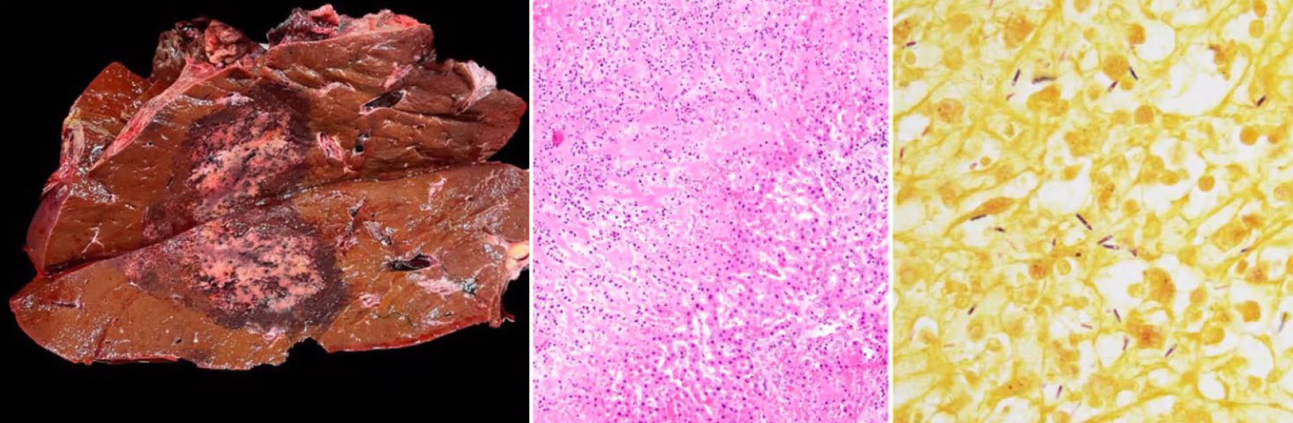 <p>Cattle; what is the etiology?</p><p>A- Clostridium haemolyticum</p><p>B-Clostridium septicum</p><p>C-Clostridium chauvoei</p><p>D-Paraclostridium sordellii</p>