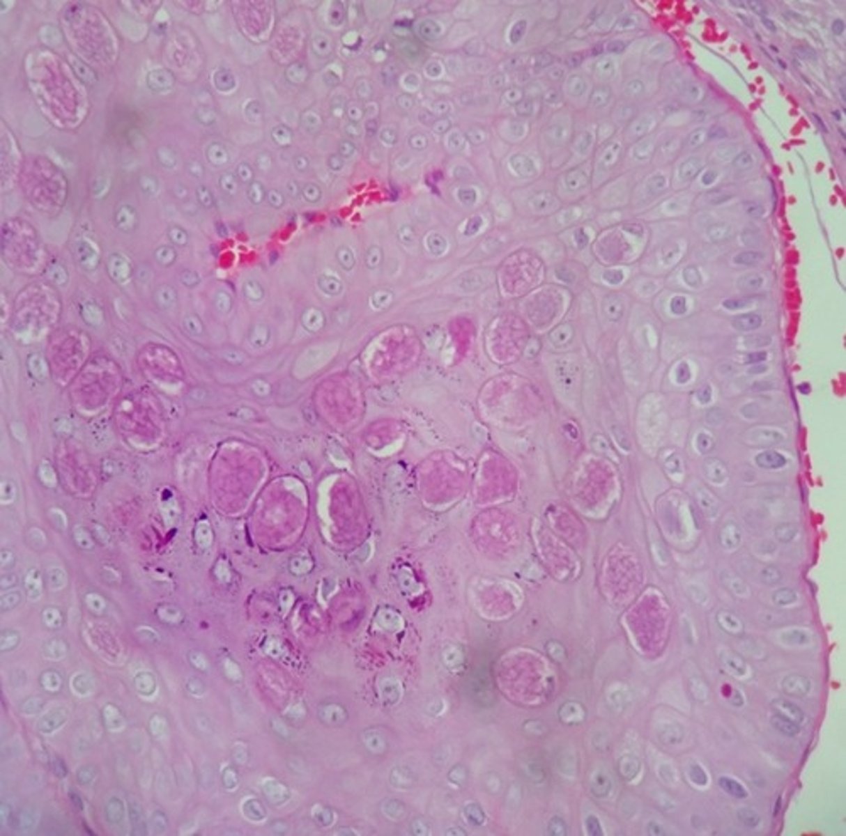 <p>Transmission</p><p>-Direct contact</p><p>Histo</p><p>-Intracytoplasmic Eosinophilic inclusion bodies</p><p>**Only dsDNA virus which replicates outside of the Nucleus**</p>