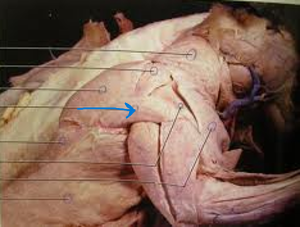 <p>What is the muscle indicated by the arrow? What is an attachment point and function?</p>