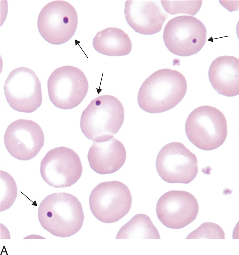 <p>what are howell-jolly bodies? (RBC inclusions)</p>