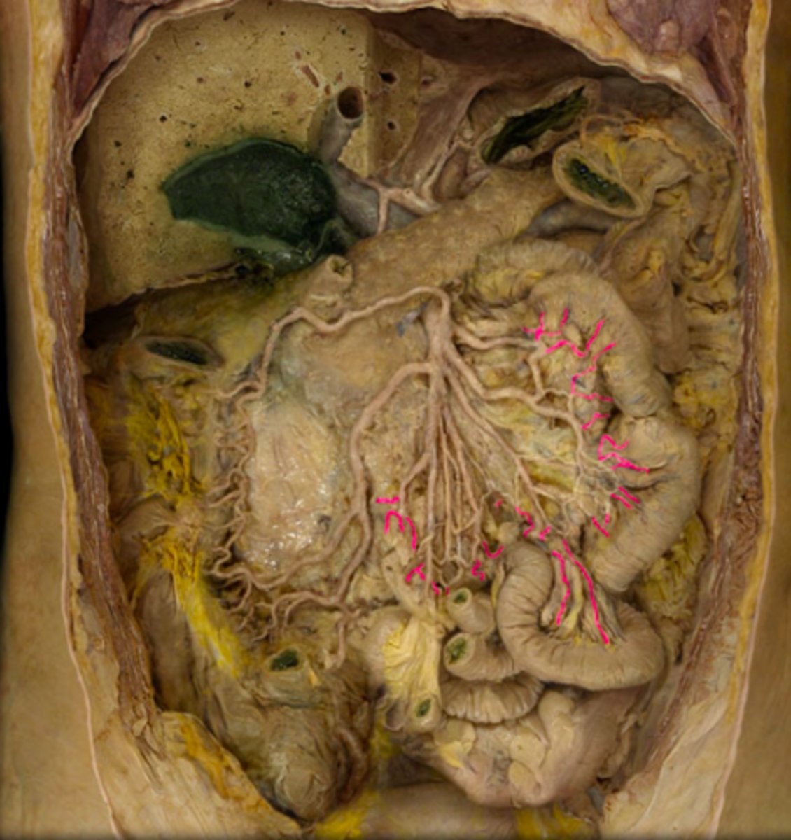 <p>artery</p>