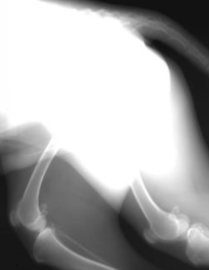 <p>the image appears too bright and/or grainy as a result of not enough beam reaching the detector</p>