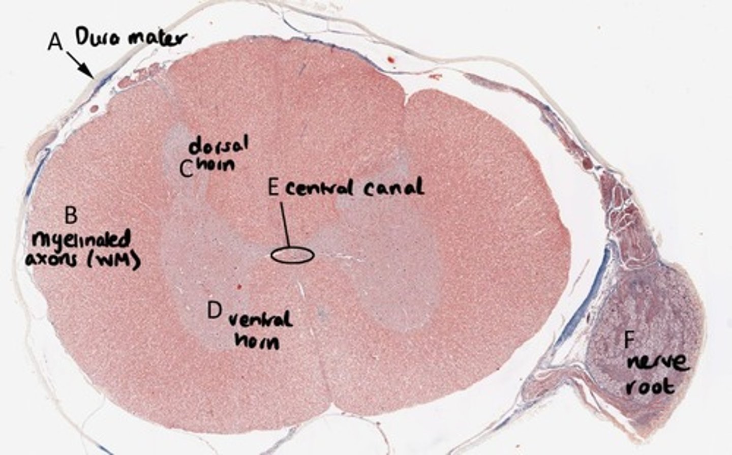 <p>A = Dura mater</p><p>B = White matter</p><p>C = Dorsal horn</p><p>D = Ventral horn</p><p>E = Central canal</p><p>F = Nerve root</p>
