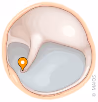 <p>what part of the ear is this</p>