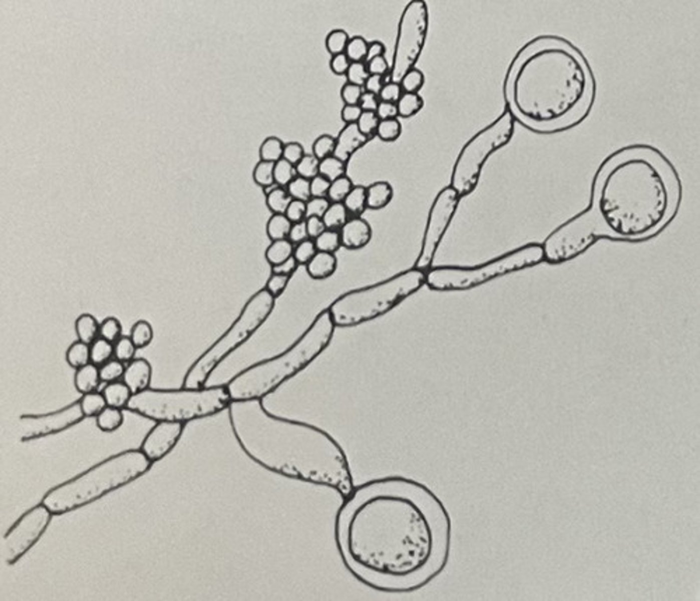 <ul><li><p>Terminal chlamydoconidia</p></li></ul><p></p>