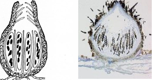 <p>Pyrenomycetes: Perithecial structures</p>
