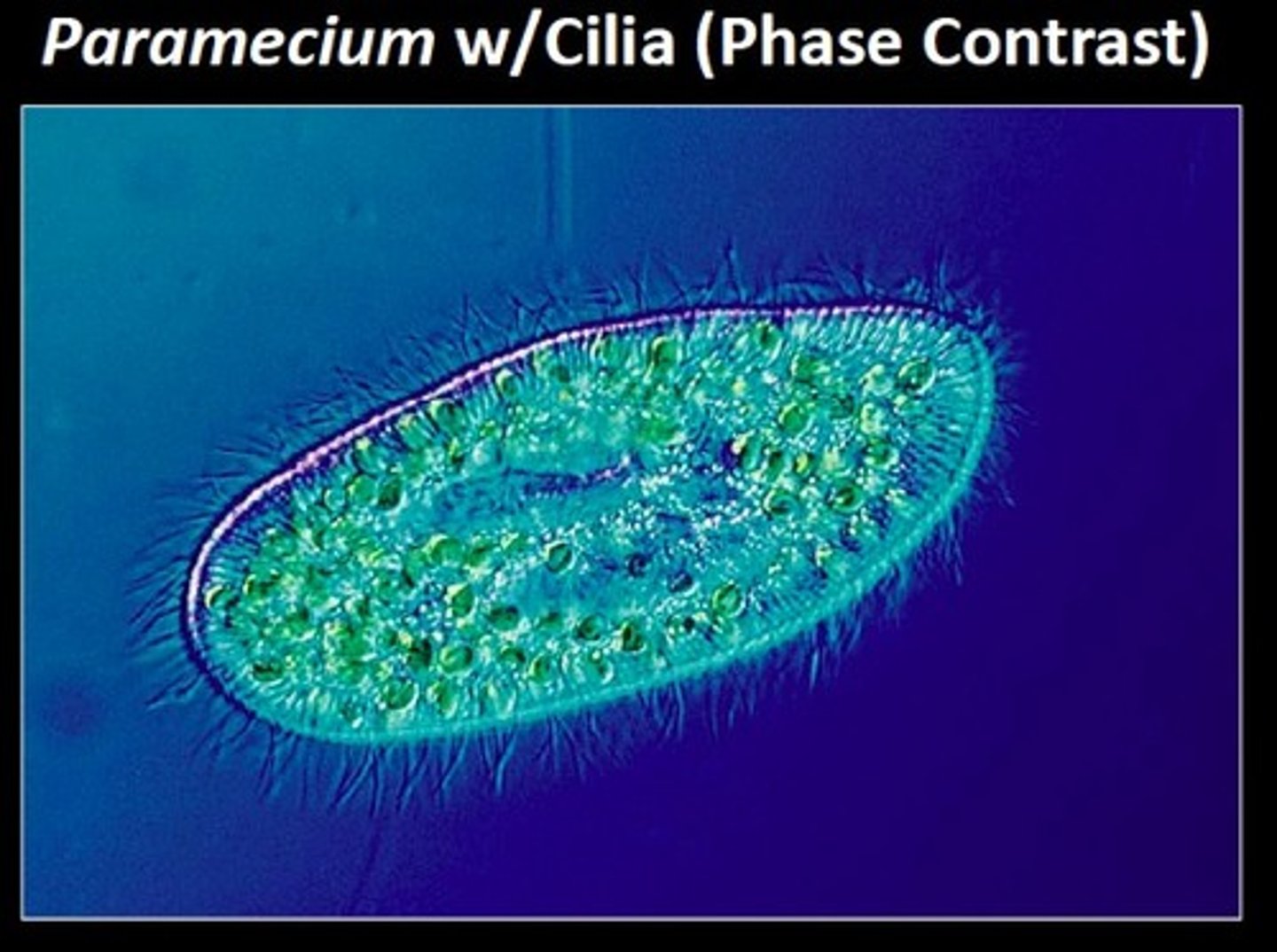 <p>light microscope that enhances contrast; useful in examining living, unstained cells</p><p>"inverted" - light source above, lens below</p>