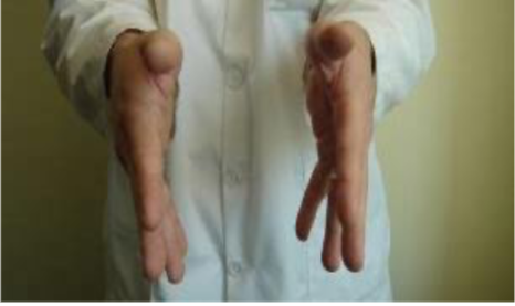 <p>Identify the Cranial Strain Pattern:</p>