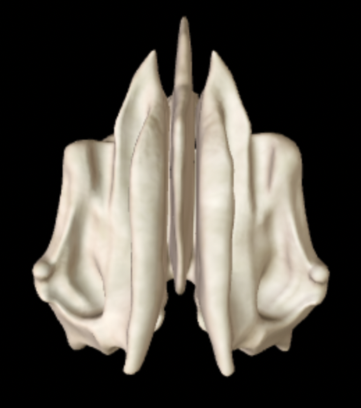 <p>Which bone is this?</p>