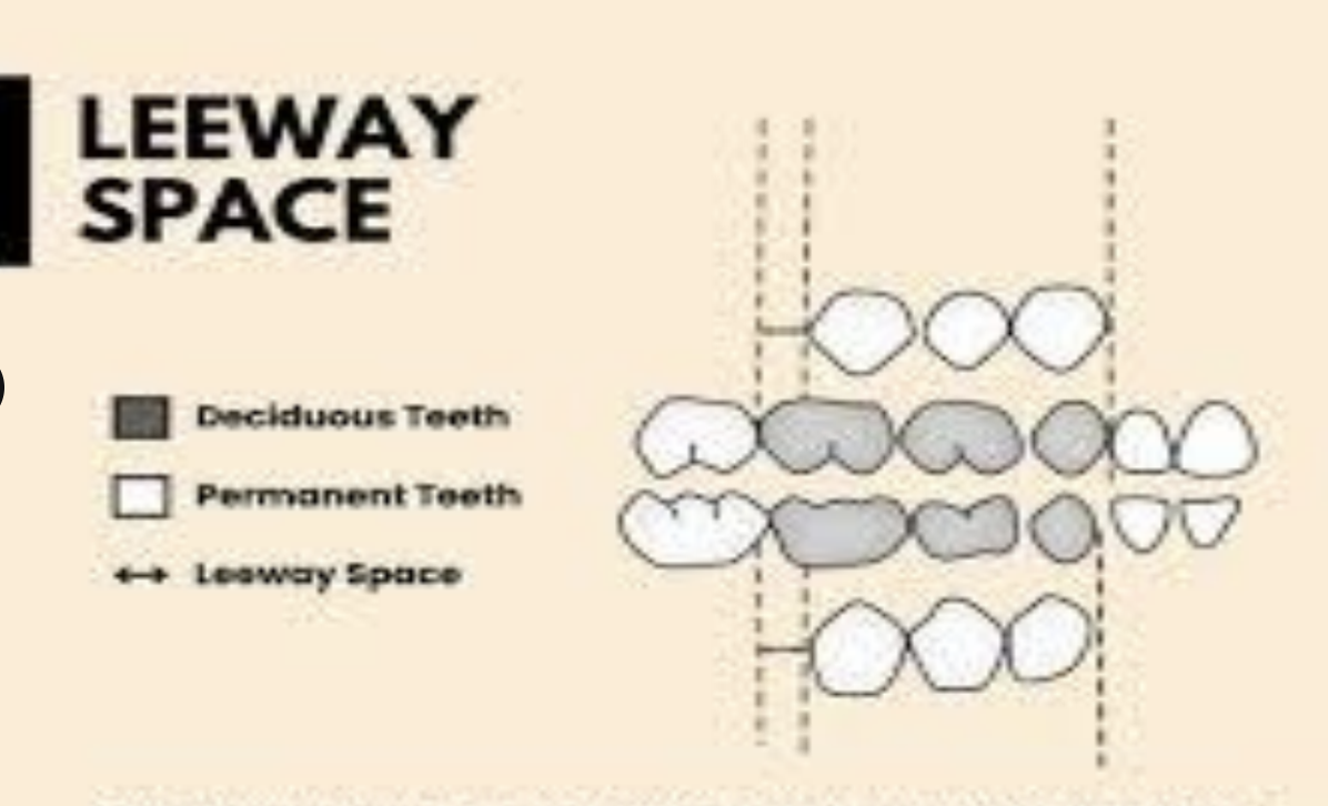 <p>Leeway space is the extra space created by the exfoliation of the primary molars and primary canines which are then replaced by narrow-er permanent premolars. </p><ul><li><p>The permanent teeth take up less space leaving the “extra space” leeway space</p></li></ul><p></p>