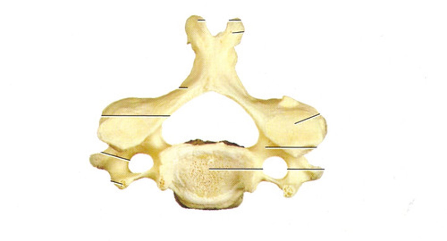 <p>Which vertebrae is this?</p>