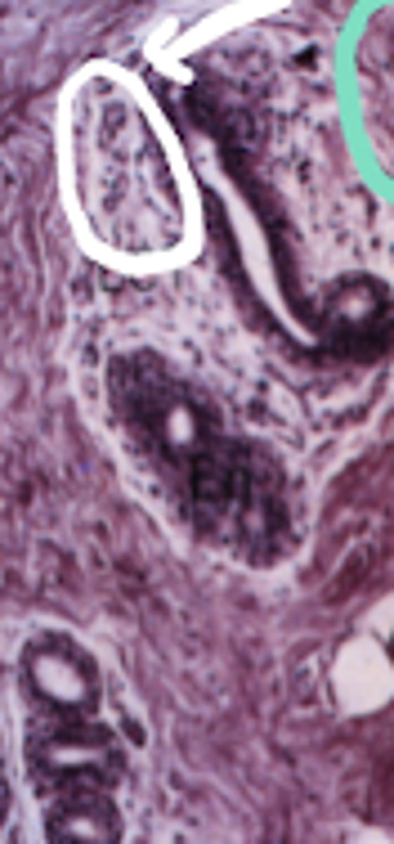 <p>What type of tissue is circled in white?</p>