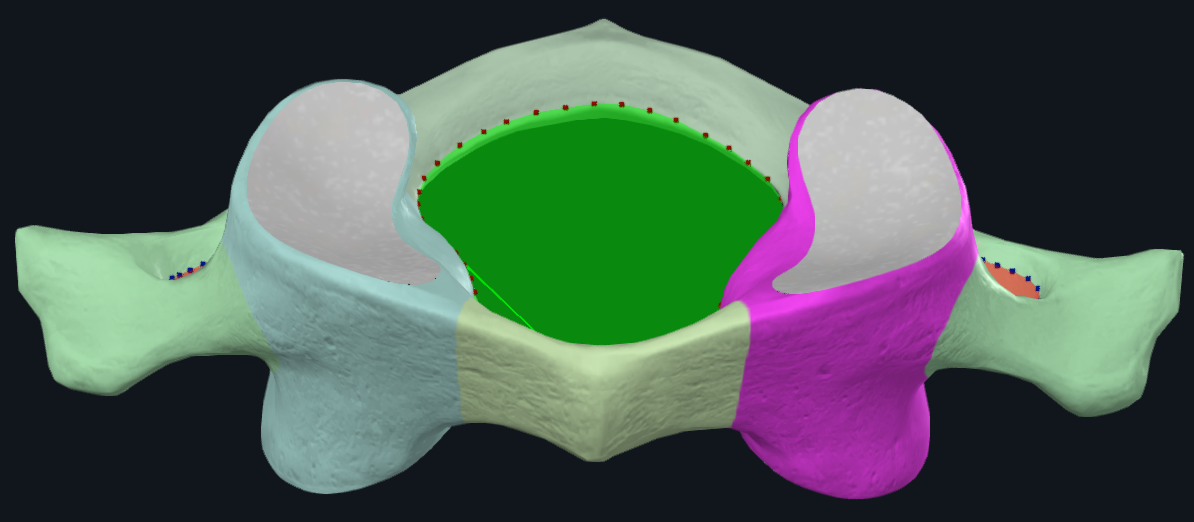 <p>name the bone and highlighted (pink/blue)</p>