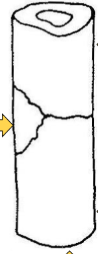 what loading type causes this bone failure  