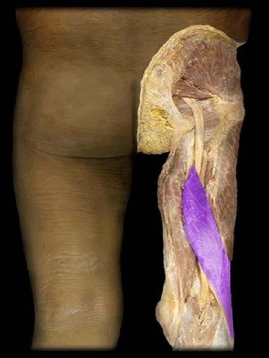 <p>What is the name of this muscle, highlighted in purple?</p>