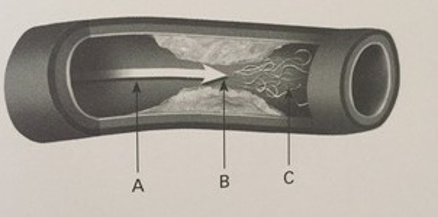 <p>380. (Peripheral arterial measurement techniques)</p><p>Where would you find the lowest pressure?</p><p>a. A</p><p>b. B</p><p>c. C</p><p>d. none of the above</p>