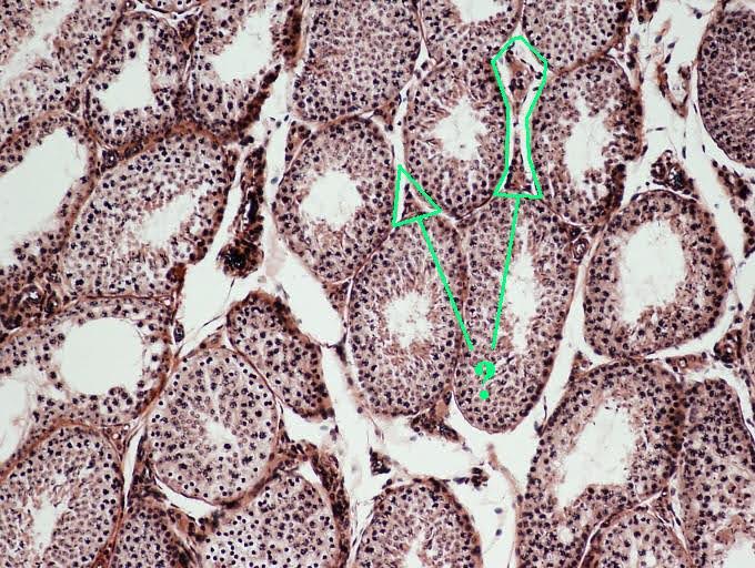 <p><span><span>What hormone is produced by the cells found in the indicated region?</span></span></p>