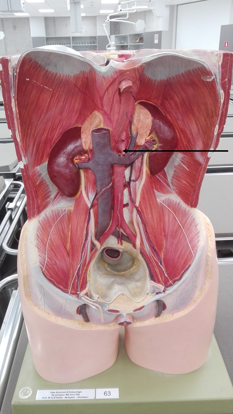 <p>arterie</p>