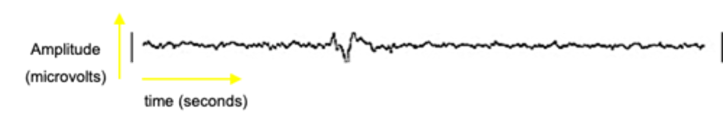 <p>What is stage 2 of sleep?</p>