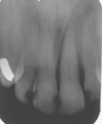 <p>identify the anomaly in this image</p>