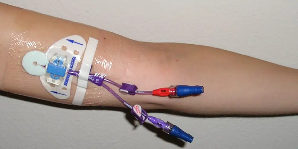<p>Talk about vascular access devices (central + peripheral lines) and their role in Candida infections </p>