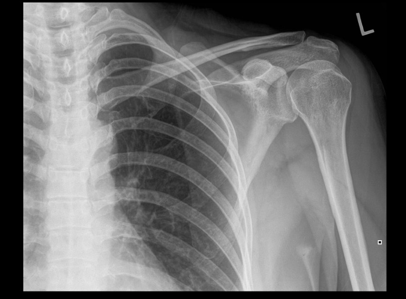 <p>What projection position is this image?</p>