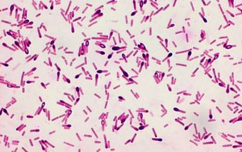 <p>what is the organism</p>
