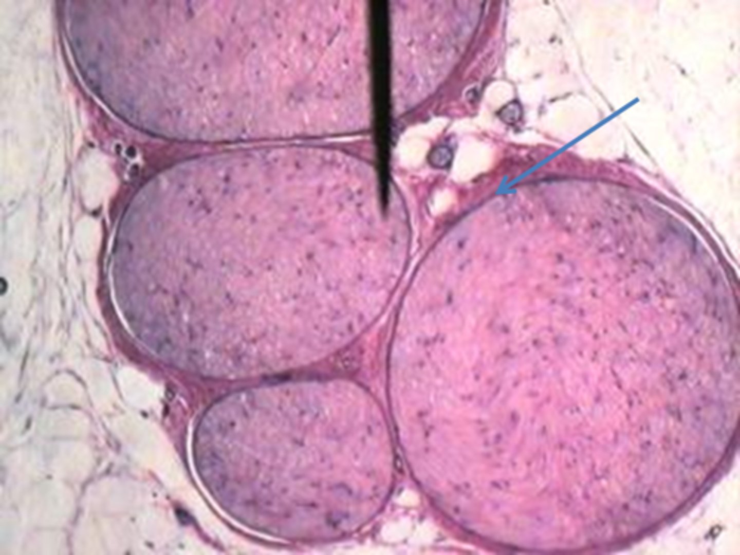 <p>bundle of fibers</p>