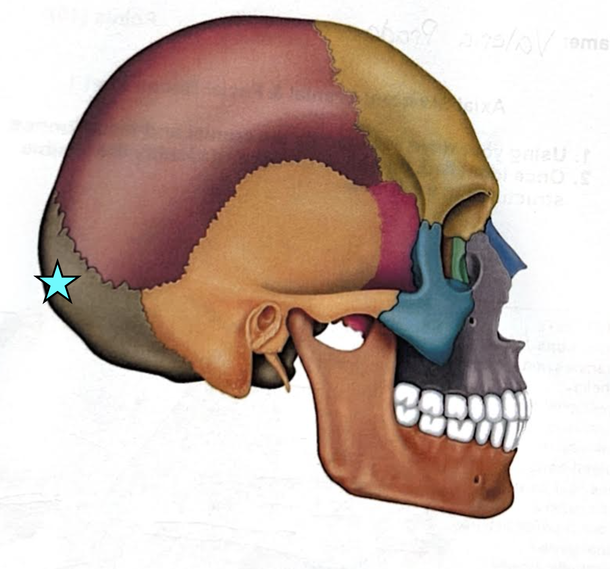 term image