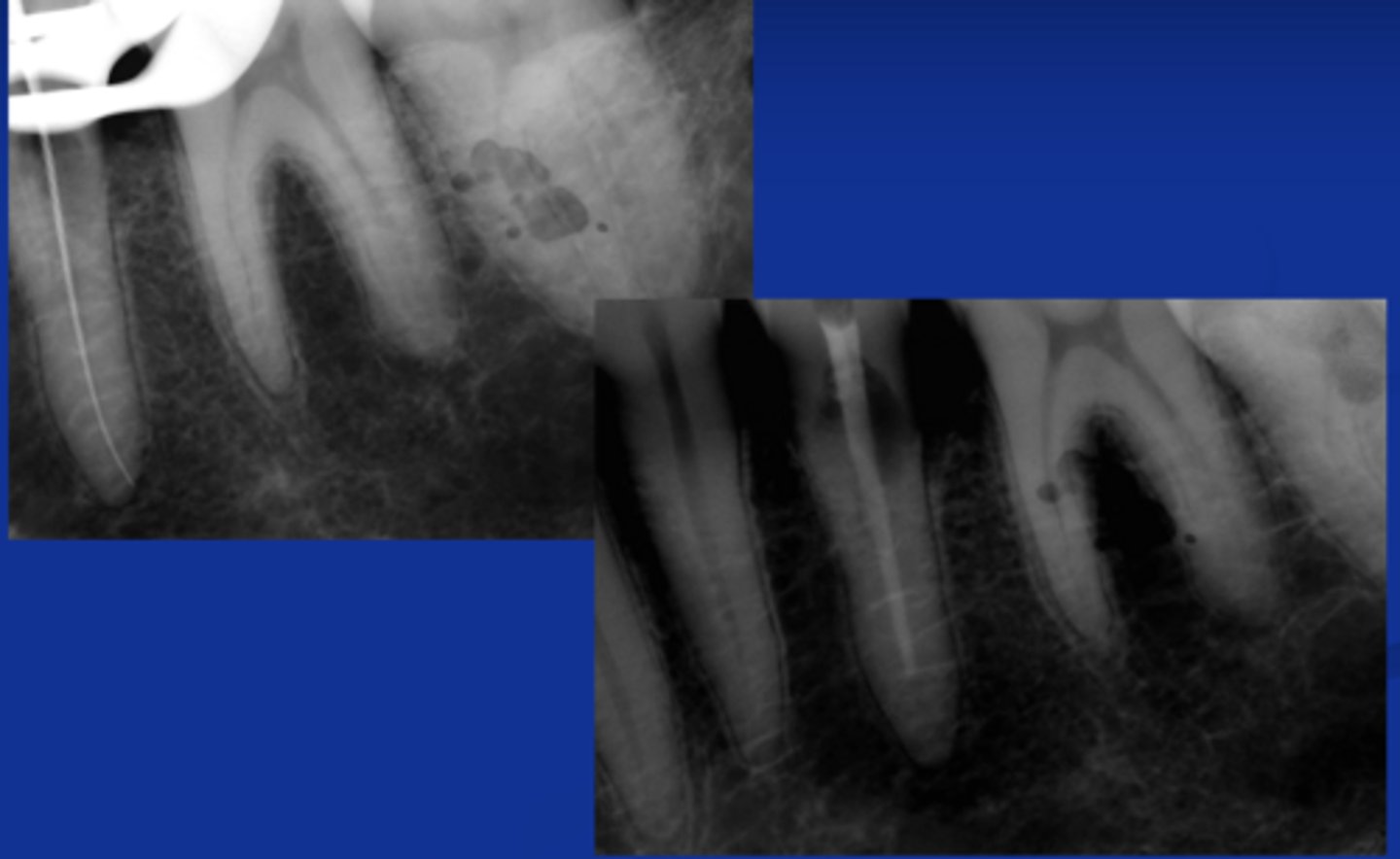 <p>What treatment is indicated?</p>