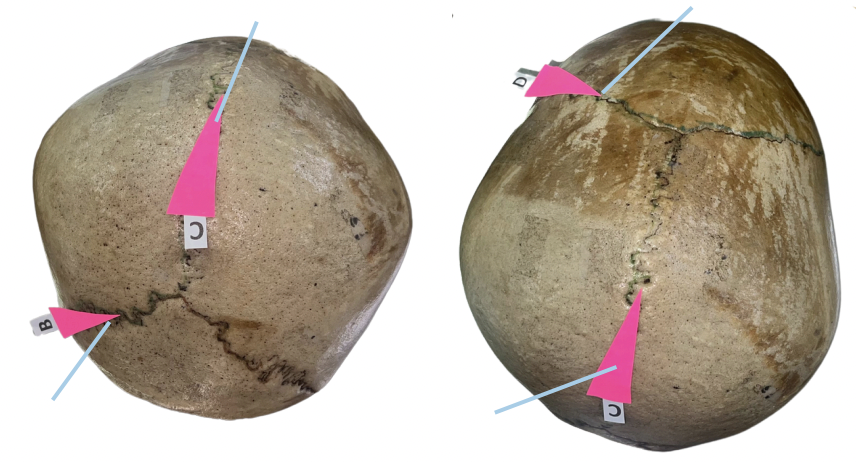 <p>Identify the suture labeled as C.</p>
