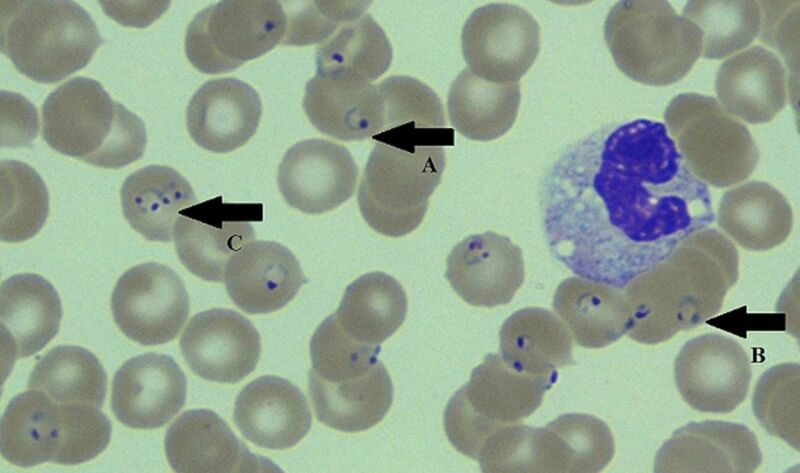 <p><strong>NOT bacteria; Protozoan parasite in red blood cells; seen by Giemsa stain, not Gram.</strong></p><p>Type: Protozoan parasite;</p><p>Disease: Malaria (most deadly type);</p><p>Diagnosis: Blood smear (look for parasite in red blood cells), rapid tests;</p><p>Treatment/Prevention: Artemisinin-based drugs; mosquito nets; vaccine exists but limited;</p><p>Spread/Unique: Carried by Anopheles mosquitoes; high resistance to drugs.</p>