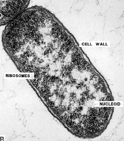 <p>It is apparent that the cell in the micrograph below is a prokaryote due to the presence of _____, which is a common characteristic of all prokaryotes. Select one: a. ribosomes b. a cell wall comprised (in part) of peptidoglycan c. a nucleoid region</p>