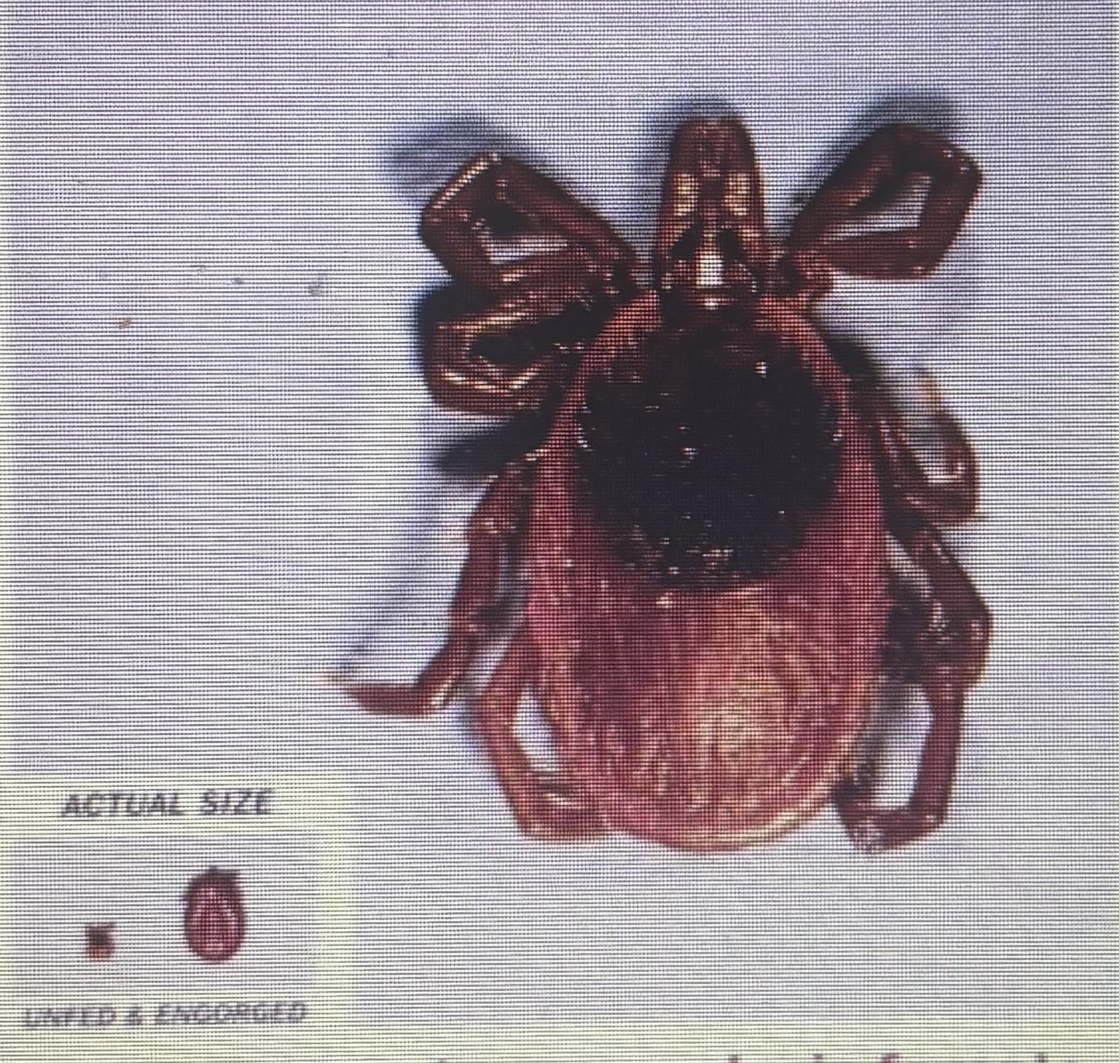 <p>Hard tick</p><p>Deer tick, black legged tick</p>