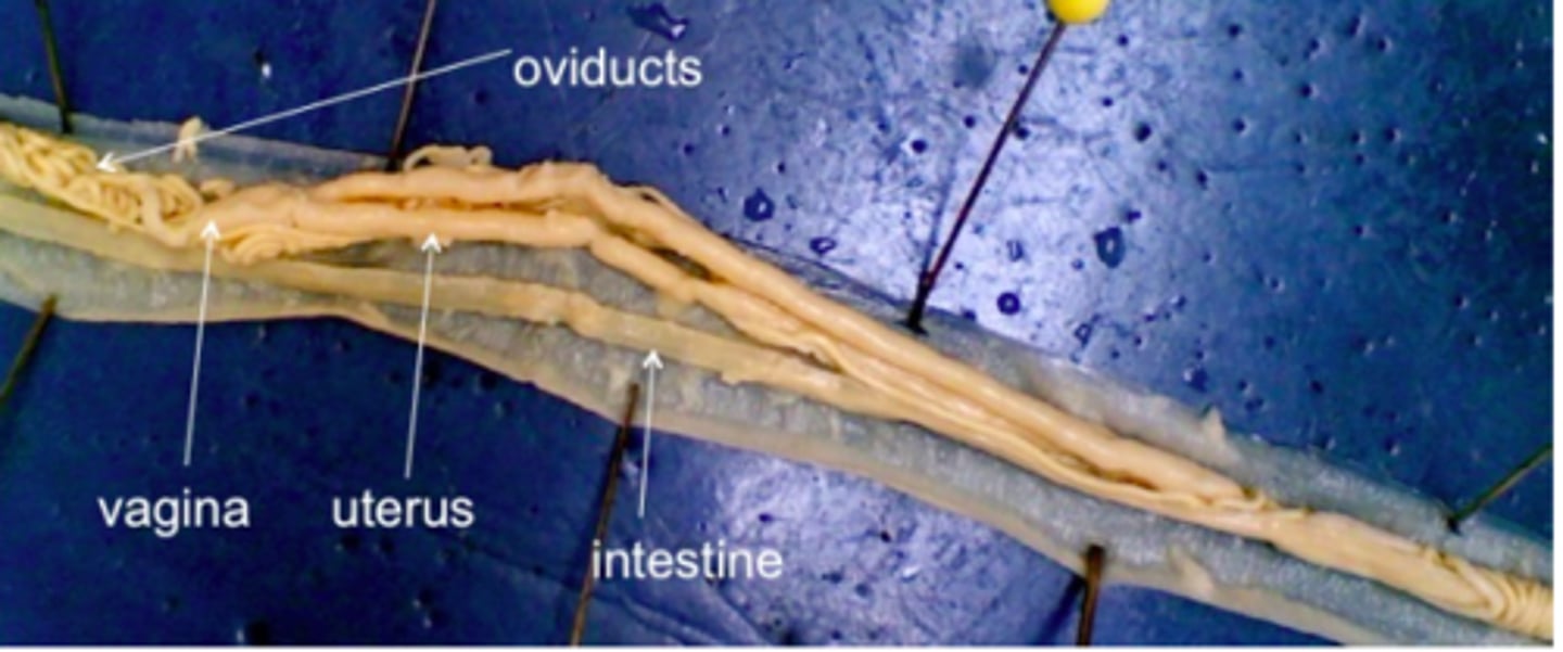 <p>Phylum Nematoda<br>oviducts, vagina, uterus, intestine</p>