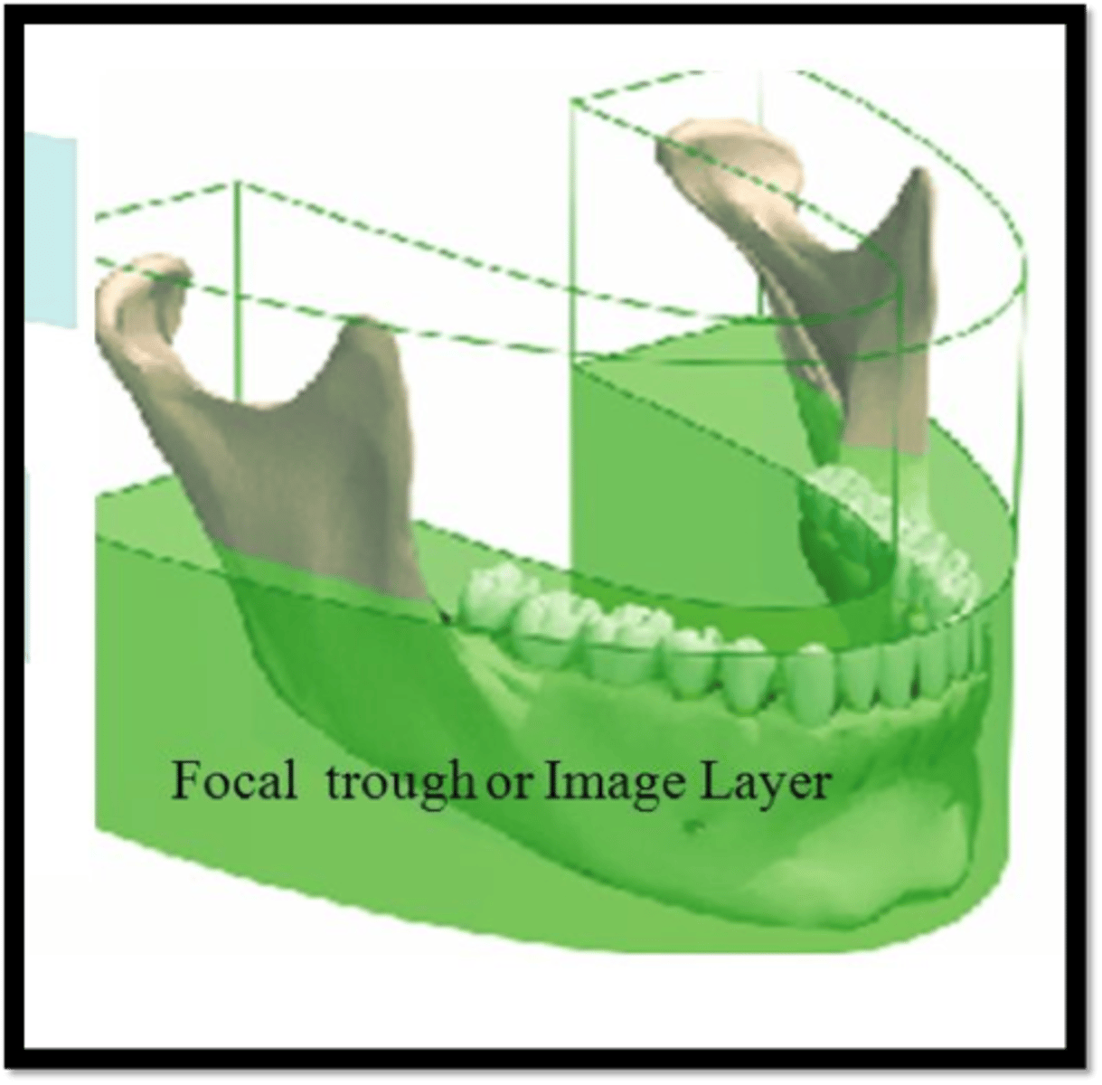<p>A three-dimensional curved zone in which structures are clearly demonstrated on a panoramic image</p>