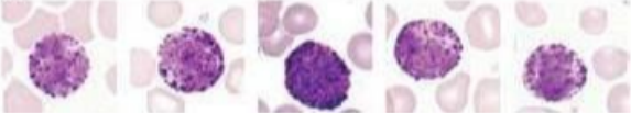 <p>What lymphocyte?</p>