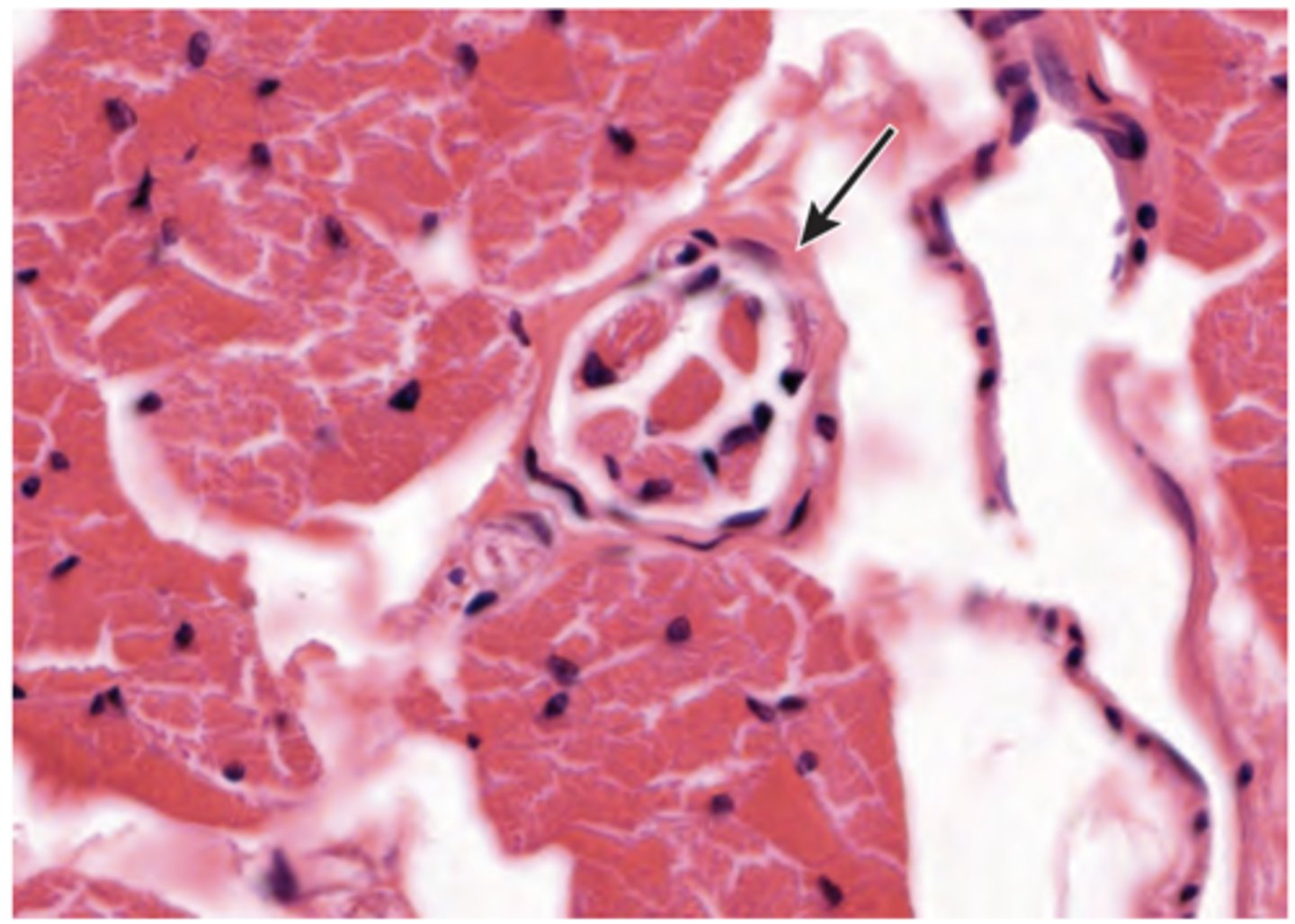 <p>A section of skeletal muscle is examined in the histology laboratory (shown in the image). Identify the structure indicated by the arrow.</p><p>(A) Muscle fascicle</p><p>(B) Muscle fiber</p><p>(C) Muscle spindle</p><p>(D) Myofibril</p><p>(E) Perimysium</p>