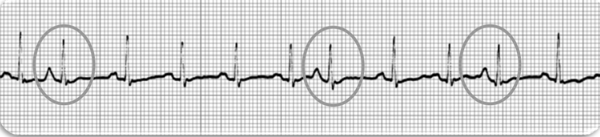 <p>what rhythm is this</p>