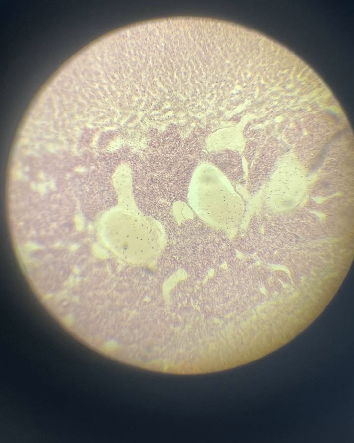 <p>Надниркова залоза </p>