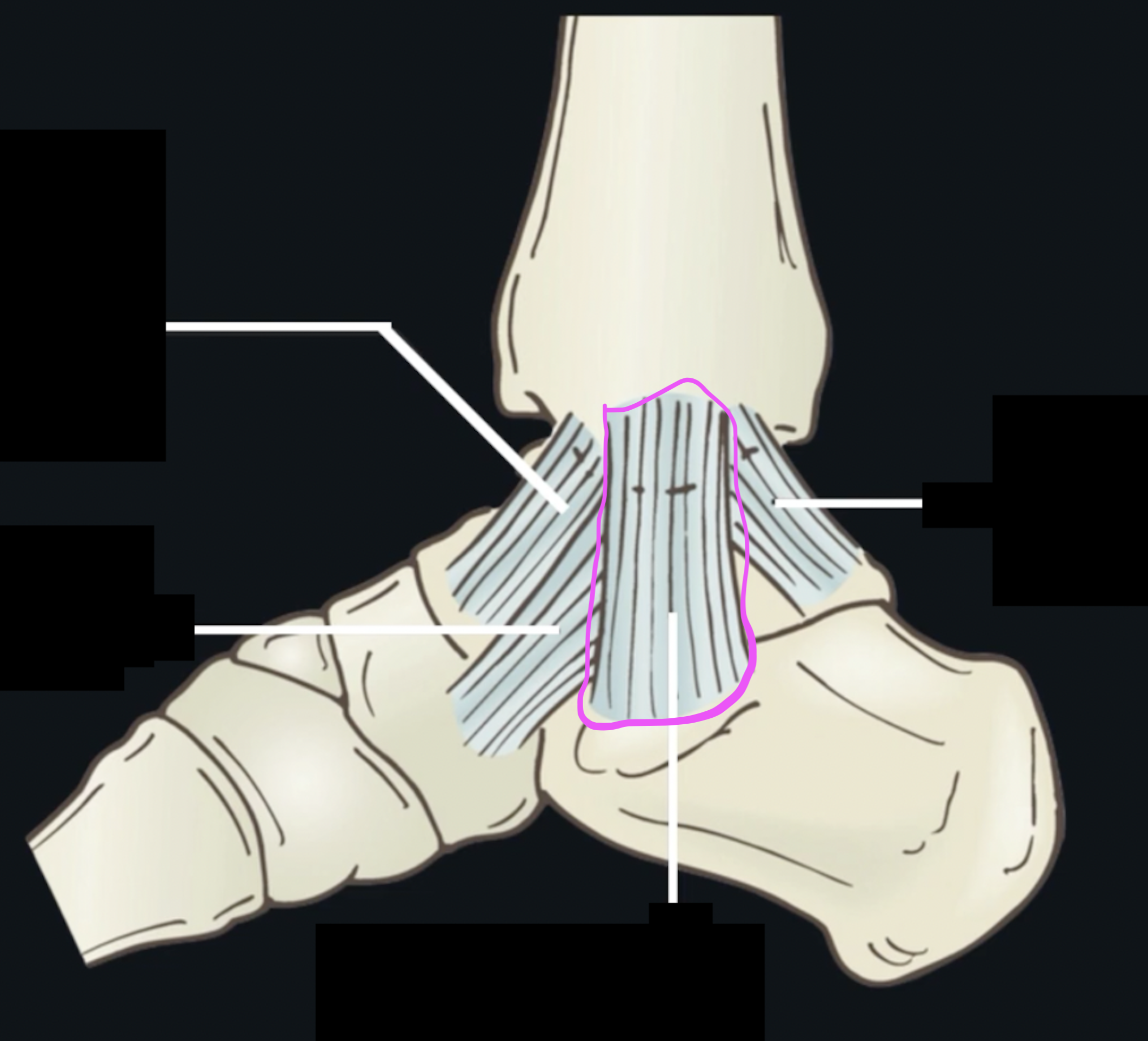 <p>What ligament is this? </p>