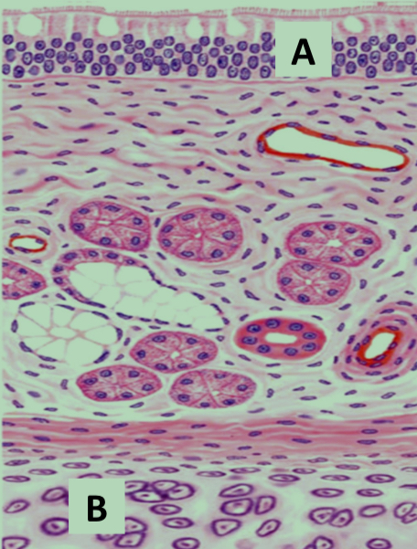 <p>What structure is labeled A in the trachea diagram?</p>
