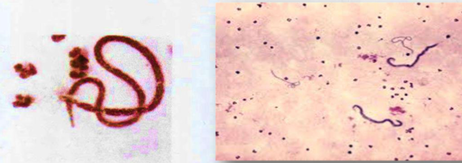 <p>Parasite under microscope</p>