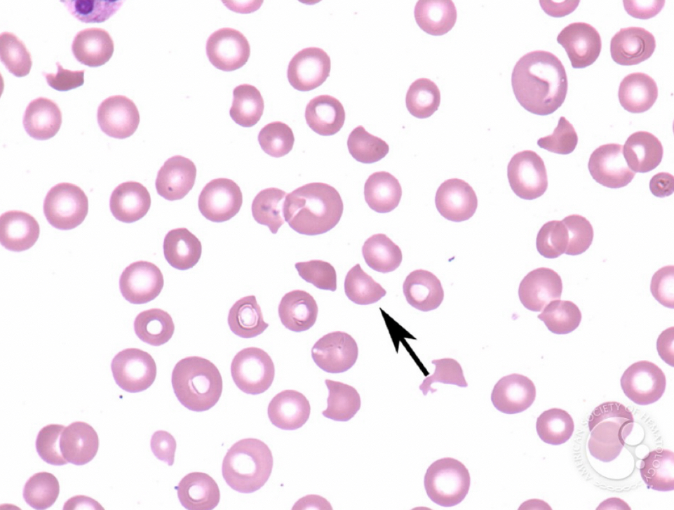 <p>What RBC is this? </p>