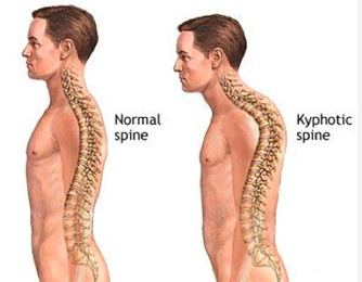 <ul><li><p><span>A kyphotic curvature </span></p></li></ul><ul><li><p><span>Made up of 12 vertebrae</span></p></li></ul><p></p>